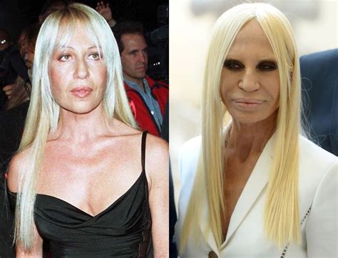 anna e donatella versace|donatella versace before and after surgery.